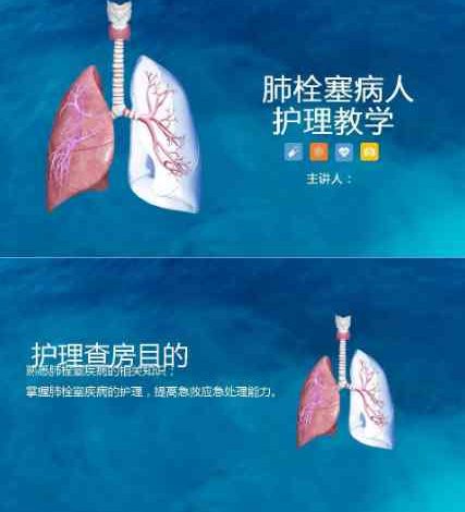 16呼吸内科-肺栓塞病人的护理