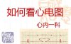 如何看心电图