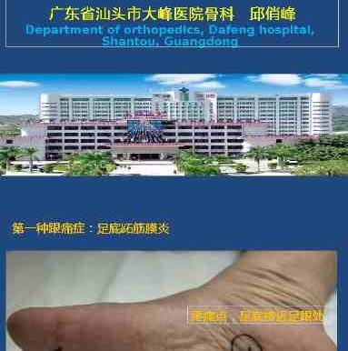 跟痛症课件